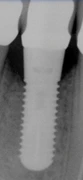 Almitech (5.6)